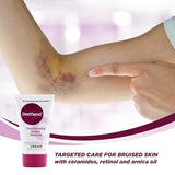 Dermend Arnica Bruise Cream with Vitamin K - Moisturizer for Bruising on Arms, Legs & Hands - 4.5 Oz